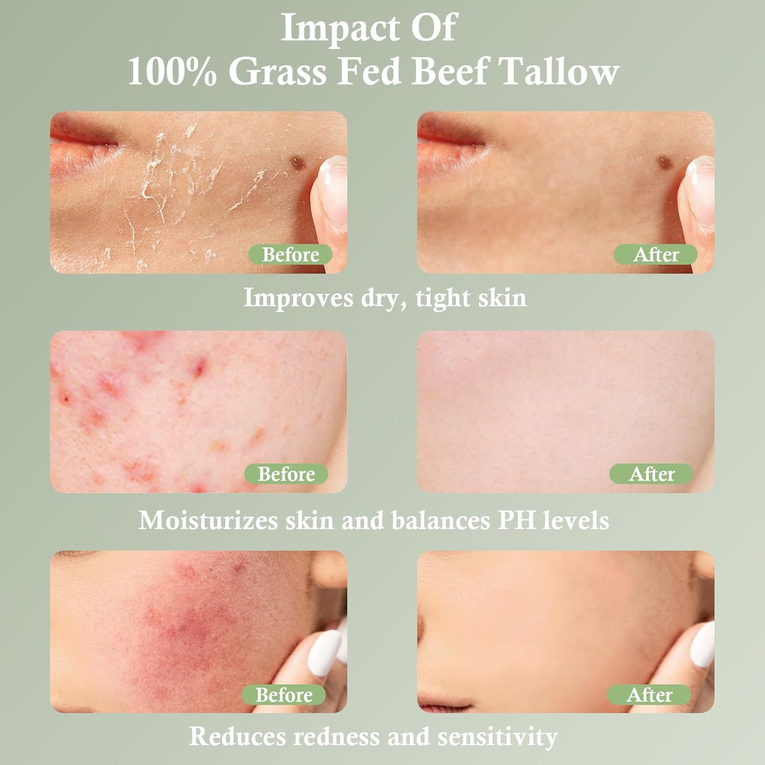 Grass-Fed Tallow Moisturizing Cream – Soothing & Nourishing Skincare