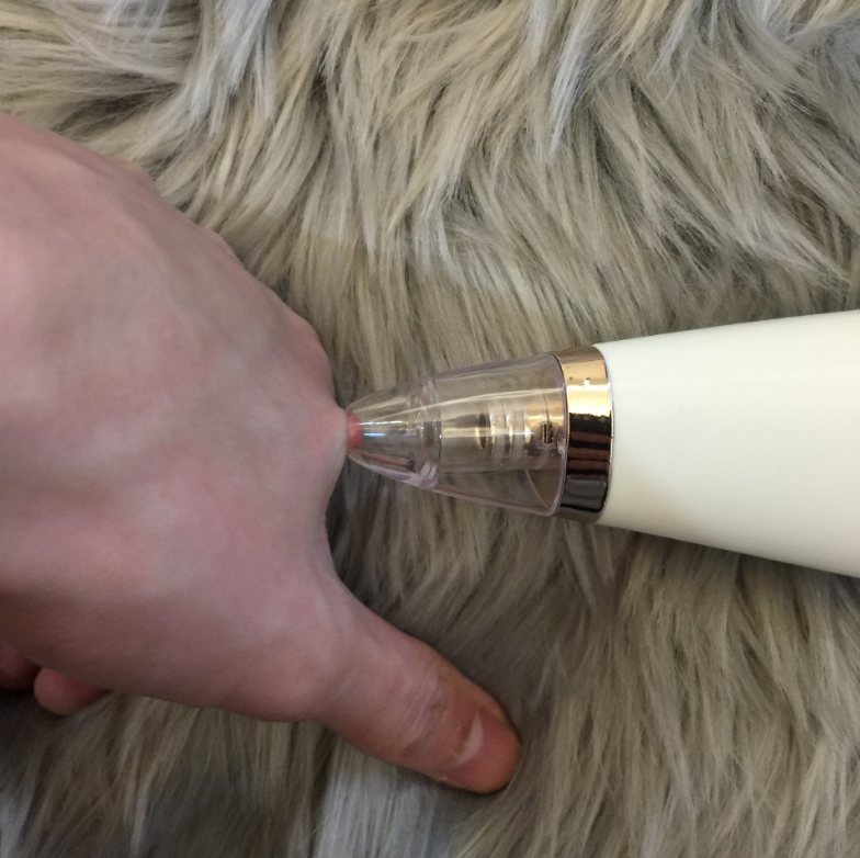 Blackhead Removal Device for Pore Cleansing and Skincare